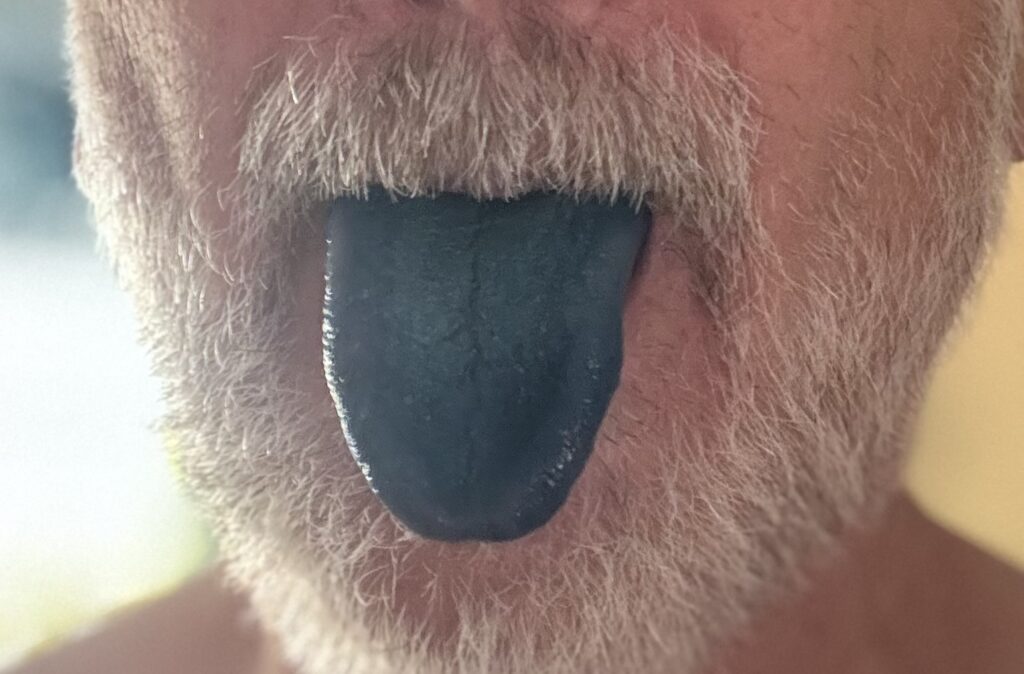 Blaue Zunge